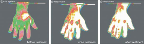 Thermograph illustration