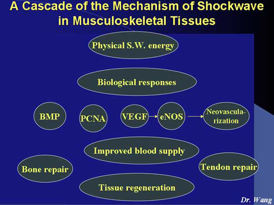 Shockwave Therapy Chart