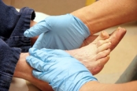 How Diabetes Affects the Feet