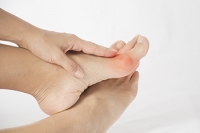 What Are Bunions?