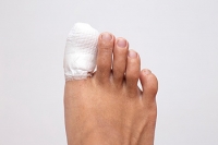 Various Ways to Break a Toe