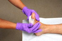 Steps for Treating a Foot Wound