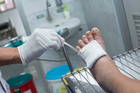 Diabetic Foot Wounds