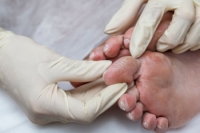 Essential Foot Care for Diabetic Feet