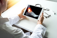 Recognizing the Symptoms of a Broken Ankle