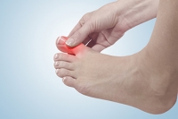The Causes of Gout