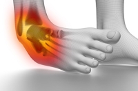 Ankle Sprains From Trail Running