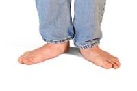 Types of Flat Feet