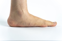 Symptoms and Relief for Flat Feet
