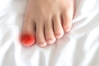 Treatment and Prevention of Ingrown Toenails