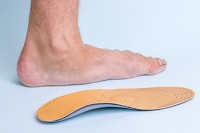 Surgery and Stretches for Flat Feet